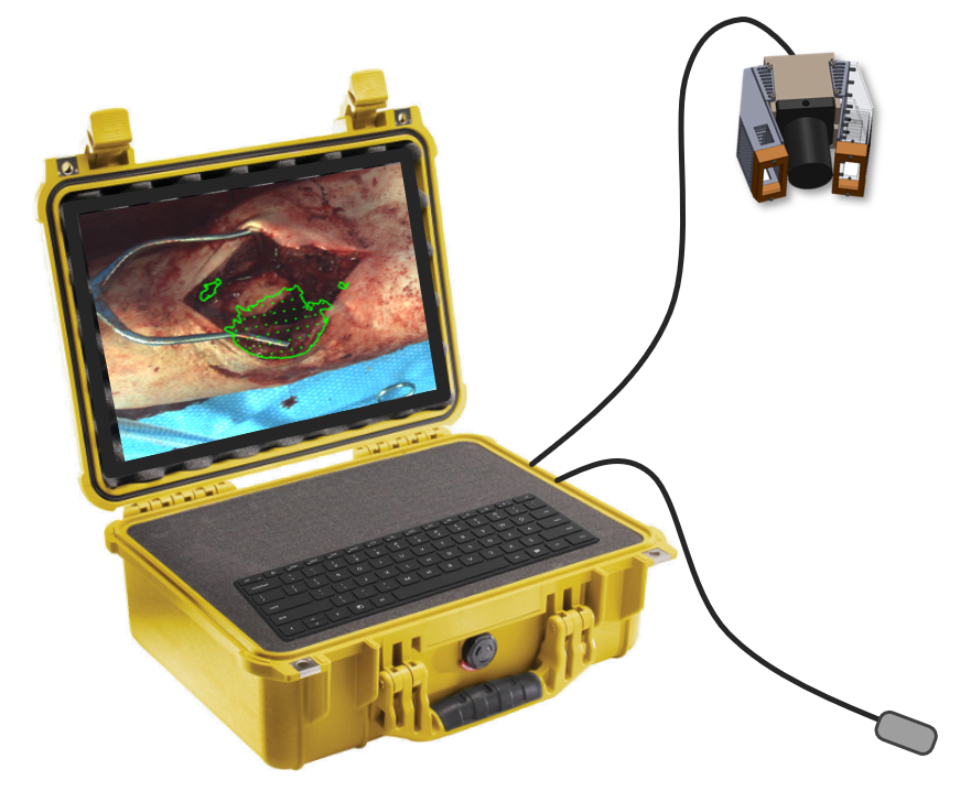 FGD Device